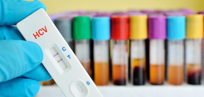 ANTI HEPATITIS C VIRUS (ANTI HCV) - TOTAL