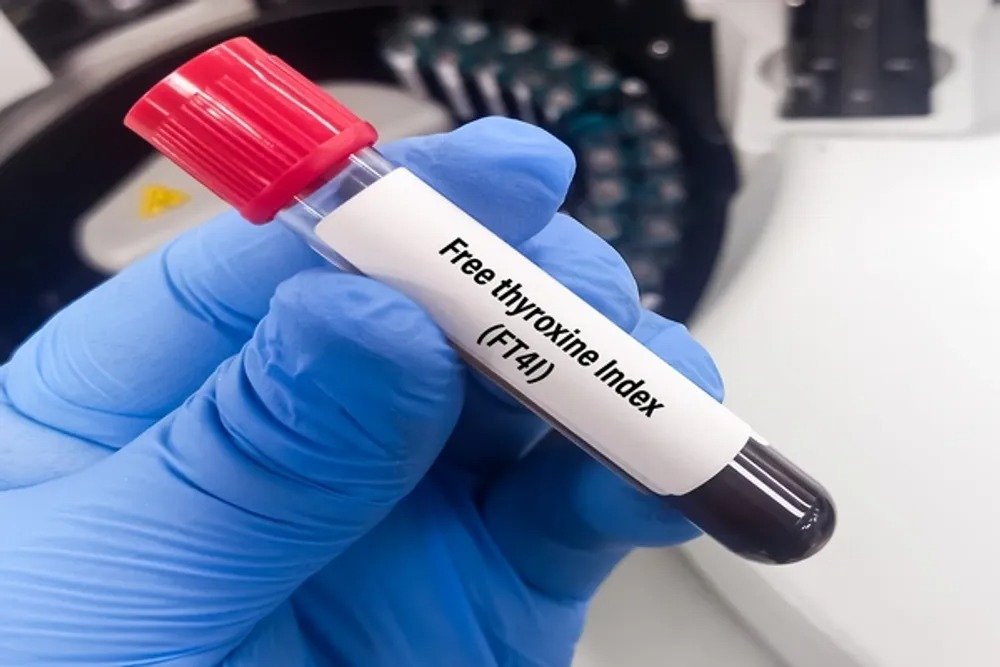 FREE THYROXINE (FT4)