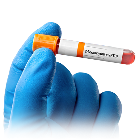FREE TRIIODOTHYRONINE (FT3)