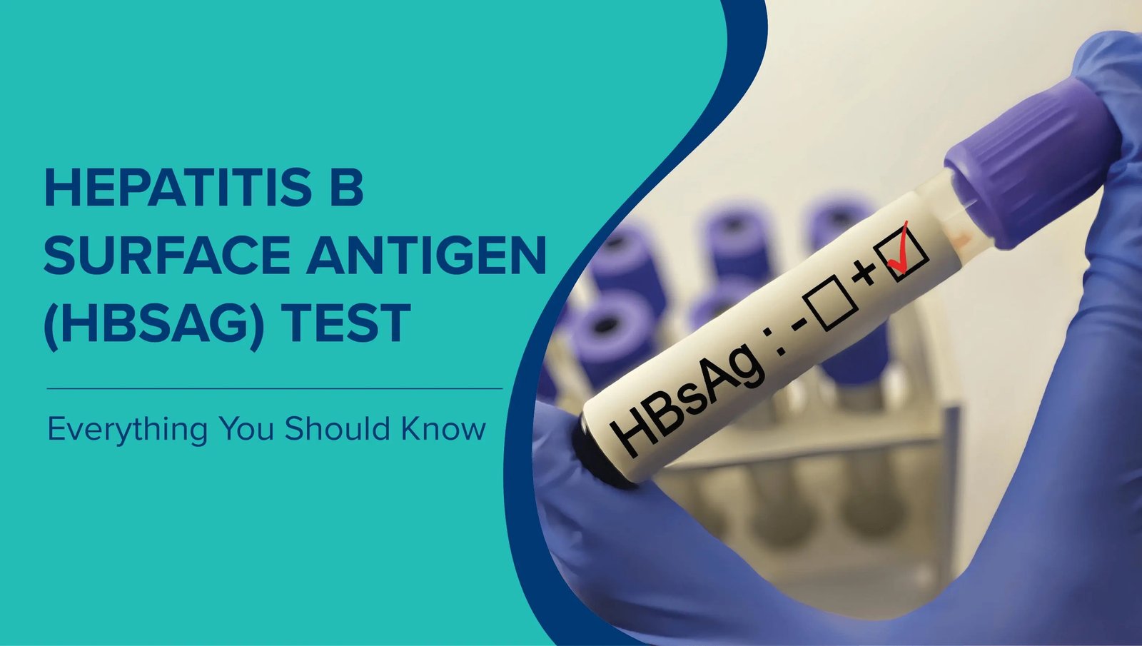 HEPATITIS B SURFACE ANTIGEN(HBSAG) RAPID TEST