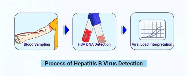 HEPATITIS B VIRUS (HBV) QUANTITATIVE PCR