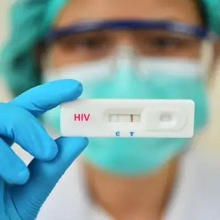 HIV 1/2 ANTIBODY RAPID TEST