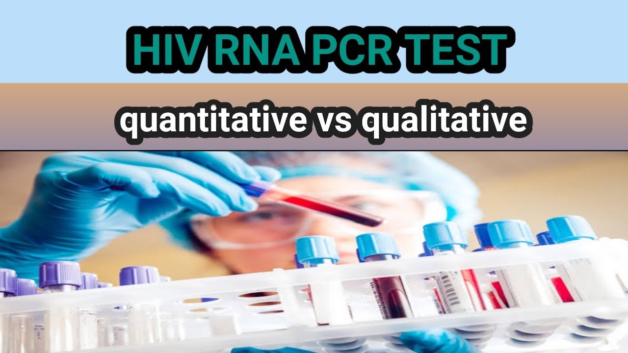 HIV-1, RNA QUANTITATIVE PCR