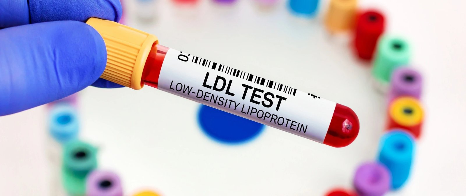 LDL CHOLESTEROL - DIRECT