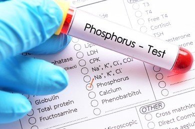 PHOSPHOROUS