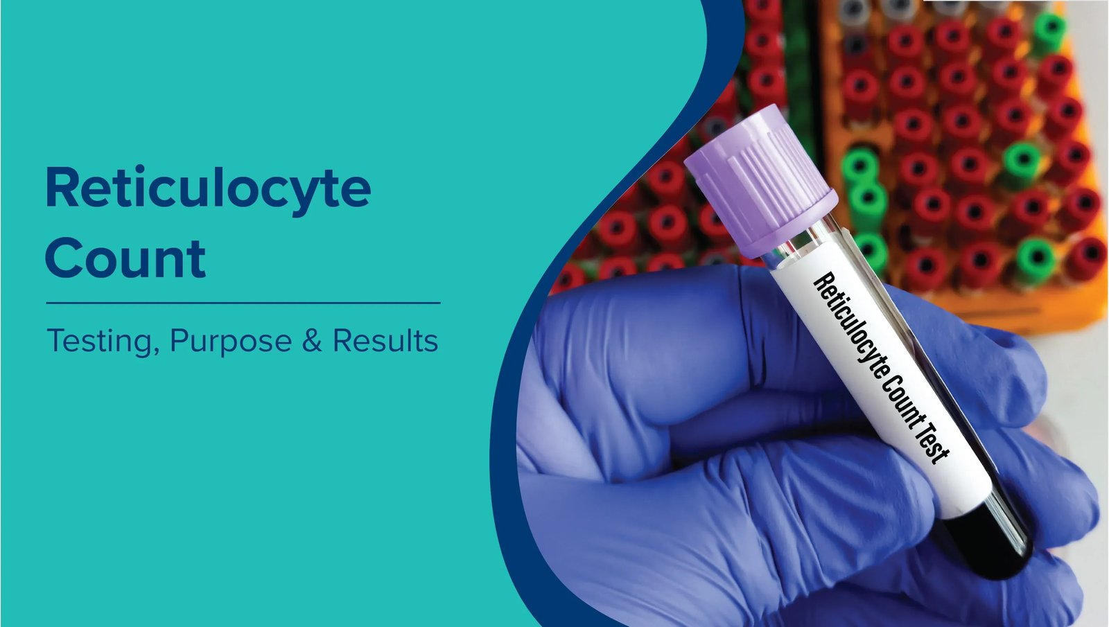 RETICULOCYTE COUNT (%)