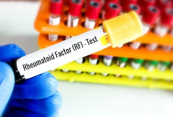 RHEUMATOID FACTOR (RF)