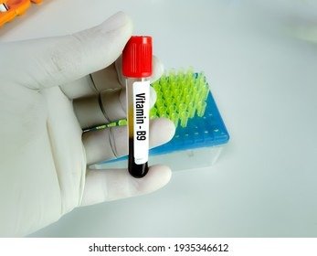 VITAMIN B9/FOLIC ACID