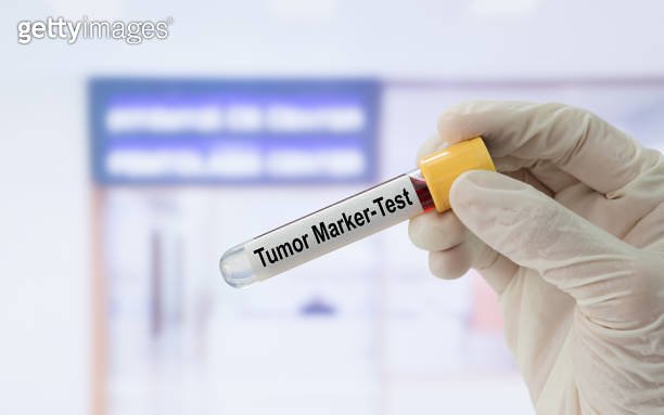 Tumour Test